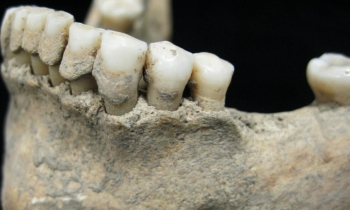 Informazioni e suggerimenti per evitare i danni da placca: dagli antichi masticatori all’efficacia clinica degli oli essenziali