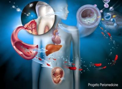 Periomedicine